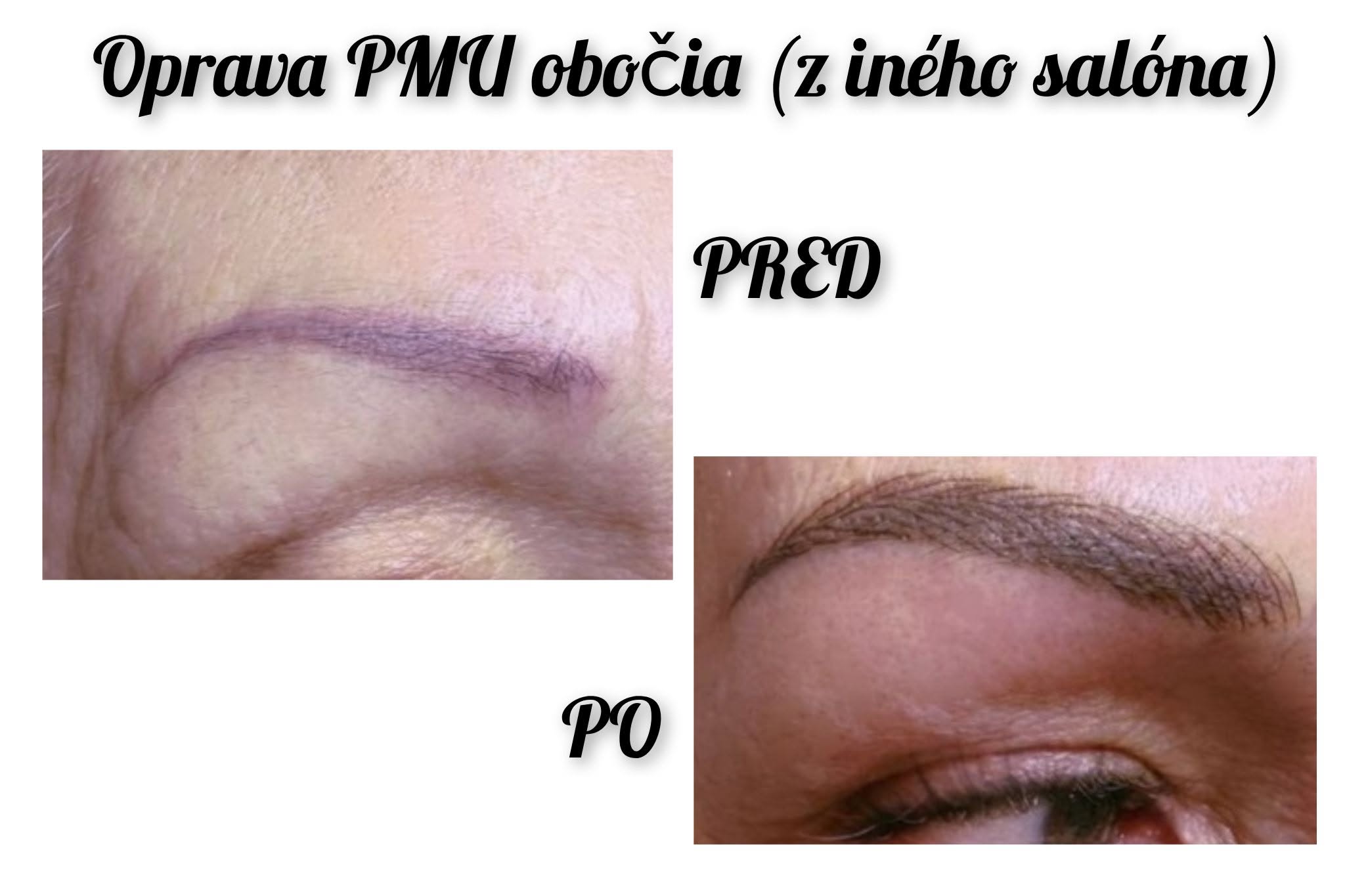 Predlžovanie mihalníc detail aplikácie rias